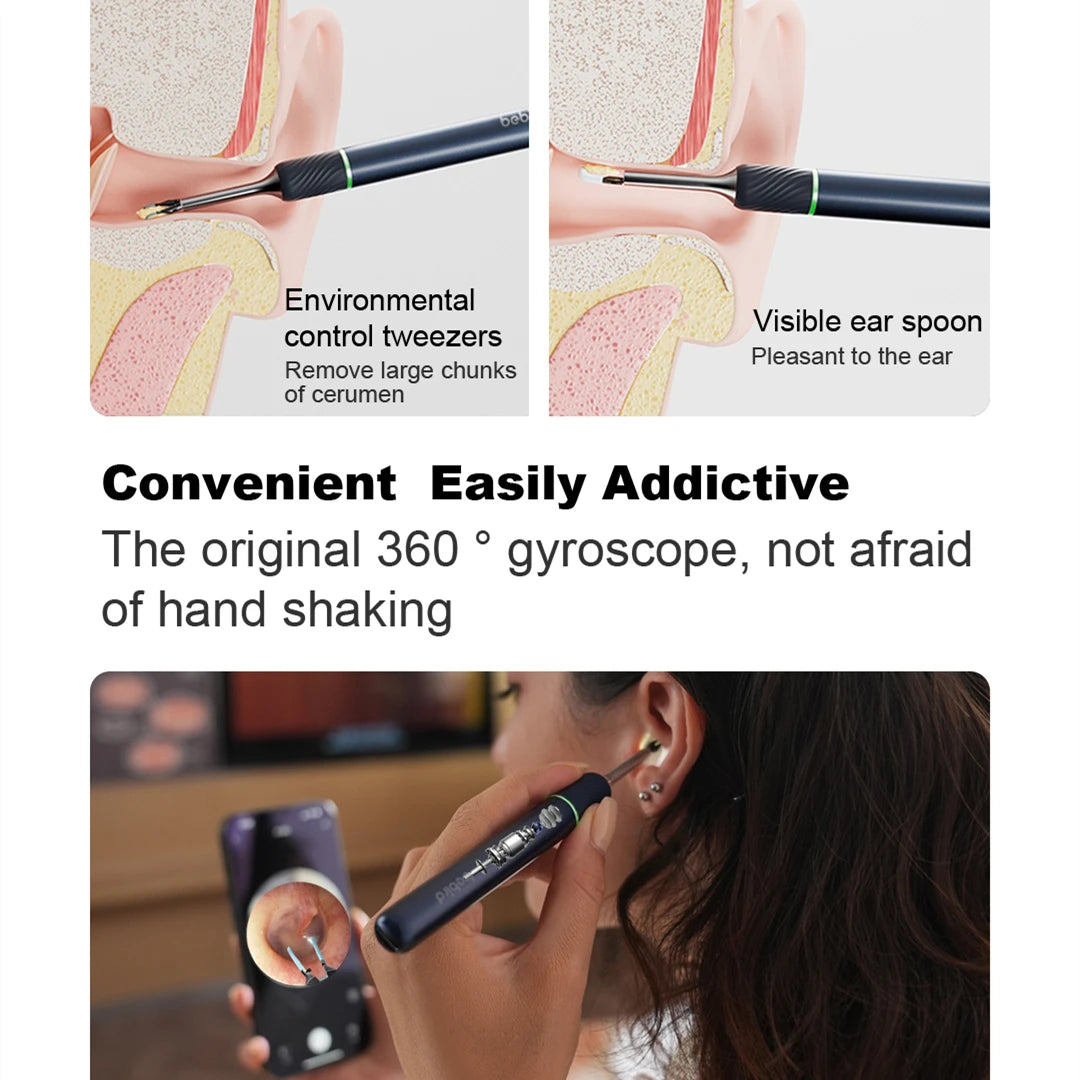 Bebird Note5 Smart Visual Ear Sticks Endoscope Tweezers High Precision